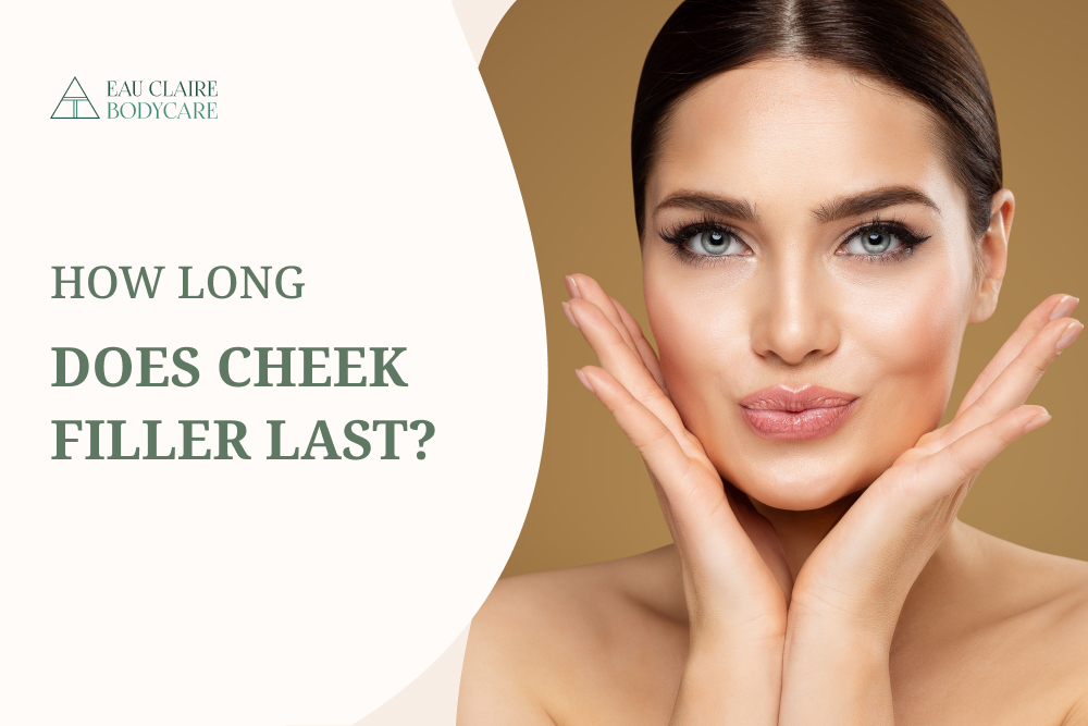 How long does cheek filler last?