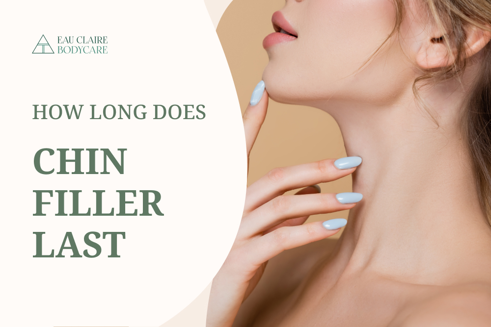 How long does chin filler last