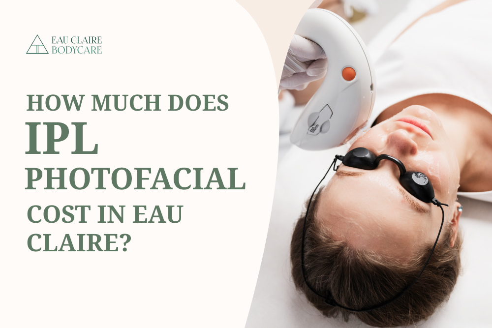 How much does IPL Photofacial Cost in Eau Claire
