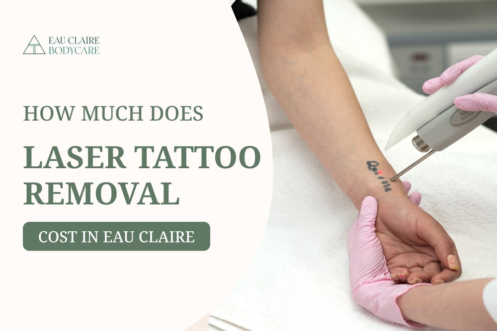 How much does Laser Tattoo Removal cost in Eau Claire?